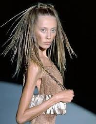 That anorexic person may