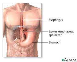  Achalasia  - series