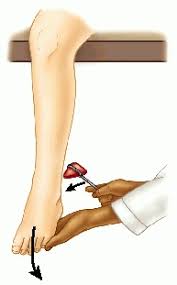 triceps surae  reflex  plantar