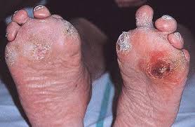 http://www.archrheumatol.net/images/img57a.jpg