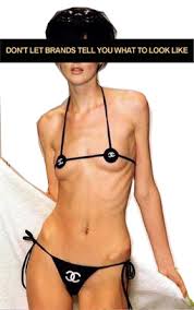 anorexic.jpg