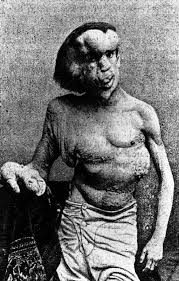 Image John McCains Elephant Man Picture