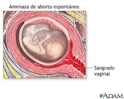 http://www.nlm.nih.gov/medlineplus/spanish/ency/images/ency/fullsize/17197.jpg