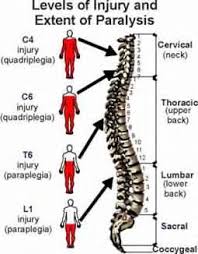 Paralysis Levels - via Daymix