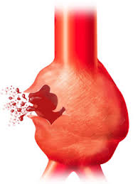  abdominal  pain or  rigidity 