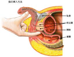 前立腺癌について