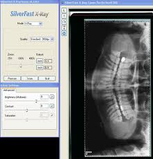 SilverFast  X-Ray 