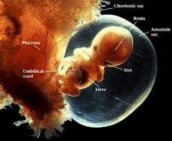The  amniotic   sac is a thin membrane    