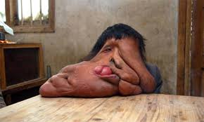 Image I am the Elephant Man: a Picture