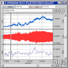  Plethysmography  | Blood Volume