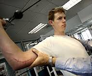 arm (Tommy John surgery).