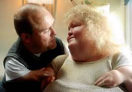 as a Thalidomide Child - via Daymix