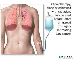 Chemotherapy is a form of - via Daymix
