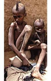 http://blog.lib.umn.edu/chhut001/uthink/malnutrition.jpg
