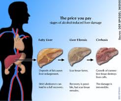 Excessive use of alcohol - via Daymix