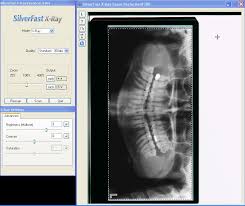 SilverFast  X-Ray 
