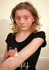 The 13-year-old girl who is