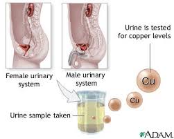 The urine is tested for the - via Daymix