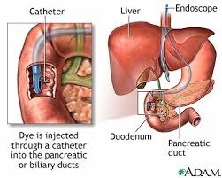http://www.nlm.nih.gov/medlineplus/ency/images/ency/fullsize/19564.jpg