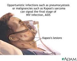 http://www.nlm.nih.gov/medlineplus/ency/images/ency/fullsize/17015.jpg