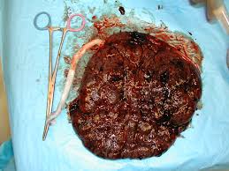 that my friend is a placenta. - via Daymix
