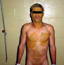 File:Abu ghraib feces 06a.jpg - via Daymix