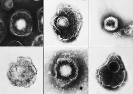 http://www.wrongdiagnosis.com/phil/images/2171.jpg