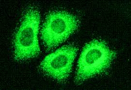 http://www.speaking-up.com/blog/wp-content/hepatitis-c1.gif