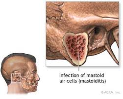 http://graphics8.nytimes.com/images/2007/08/01/health/adam/7141.jpg