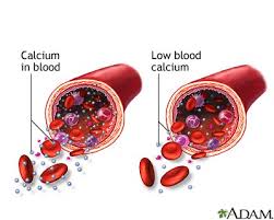 http://www.mdconsult.com/das/patient/body/0/0/10041/21729_en.jpg