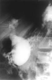   FIGURE   4 Endoscopic retrograde    