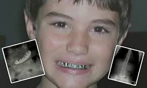 This 7-year-old boy became the