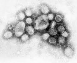 FIRST LOOK: Swine Flu Virus - via Daymix