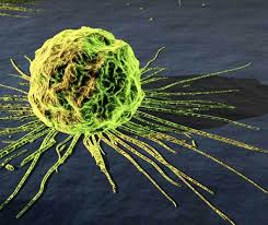 Metastasizing  Cancer 