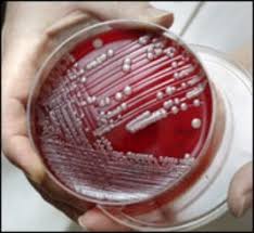 http://www.healthnewsblog.com/pics/acinetobacter.jpg