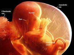 The  amniotic   sac is the fluid filled    