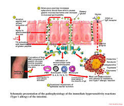 Gluten Sensitivity/Allergy - via Daymix
