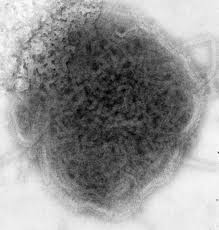  negative stained TEM 8758 lores jpg