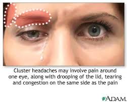 Pain of  cluster headache 