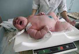 Seventeen Pound Russian Baby