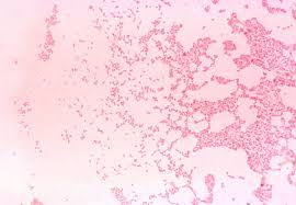 http://www.globalsecurity.org/wmd/intro/images/brucella-cdc3.jpg
