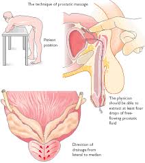 Prostate Massage