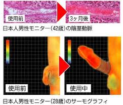この電流が勃起力を最大に強化し