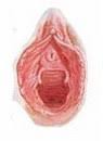 Keeping a hymen intact to