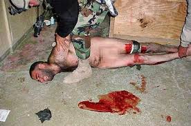 Naked Tortured Detainee - via Daymix