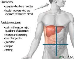 http://www.nlm.nih.gov/medlineplus/ency/images/ency/fullsize/17217.jpg