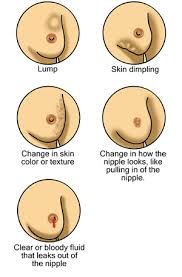 Breast Self Exam - via Daymix