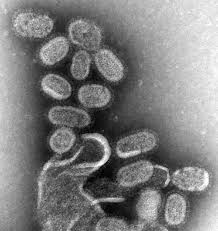 Novel A-H1N1 - via Daymix
