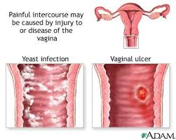 Causes of painful intercourse