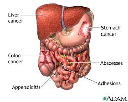  Abdominal exploration  - series